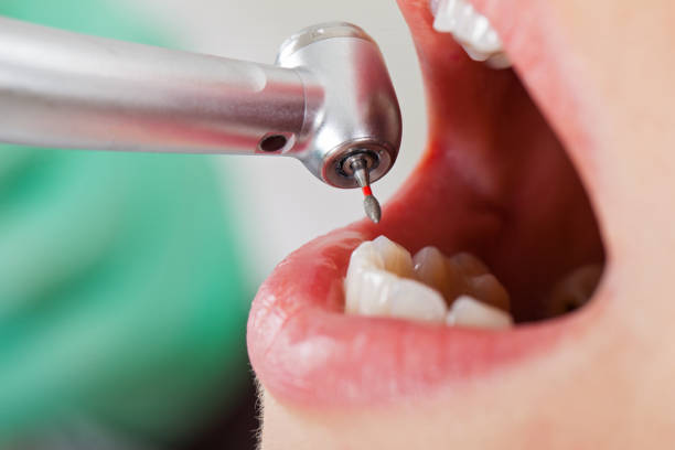 Best Emergency Root Canal Treatment in Dalworthington Gardens, TX